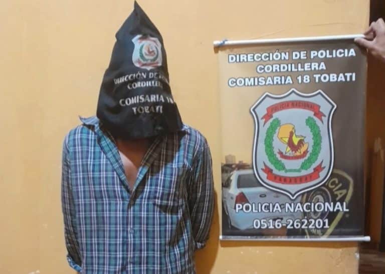 Violencia familiar extrema: Padre quema a su hija con comida caliente en Tobatí